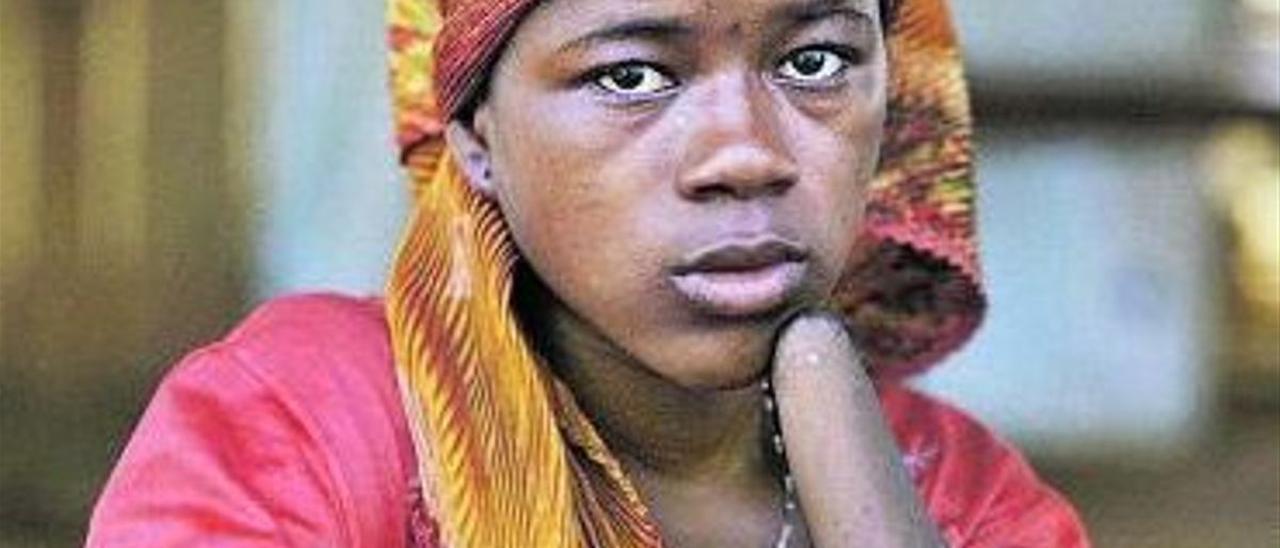 Mariatu Kamara, de 15 años, sufrió la amputación de sus dos manos durante la guerra de Sierra Leona, en 1999.