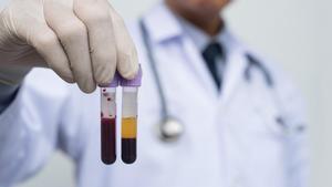 La sangre es un tejido compuesto por plasma y células.