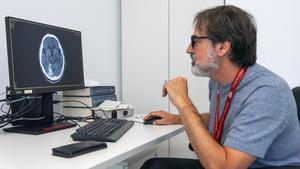 Andreu Gabarrós, jefe de Neurocirugía del hospital de Bellvitge