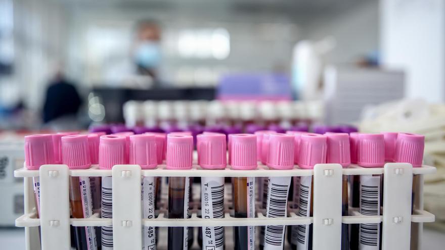 Tubos de sangre en un laboratorio