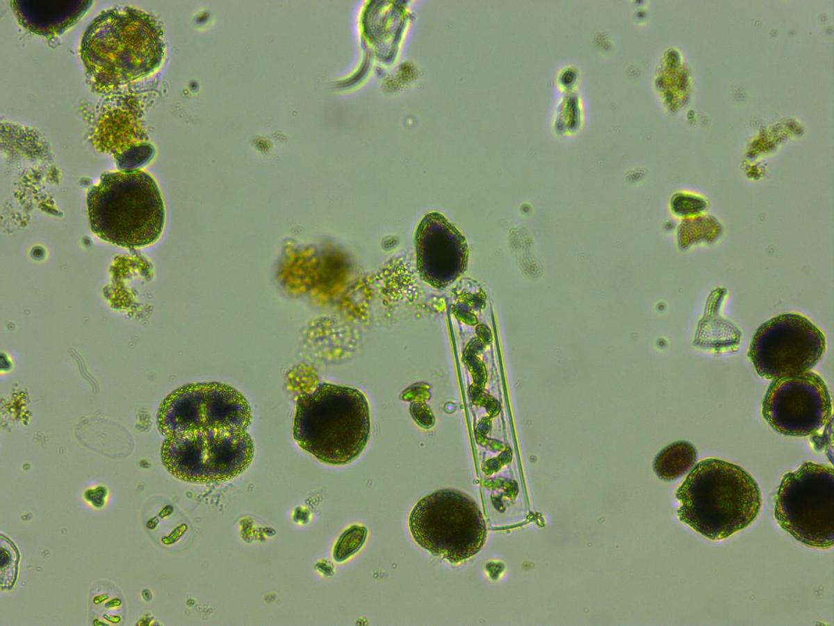 Imagen de fitoplancton vista al microscopio