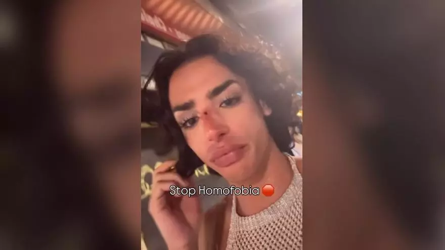 "Por ser gay y estar así vestido": un joven denuncia una agresión homófoba en Alicante