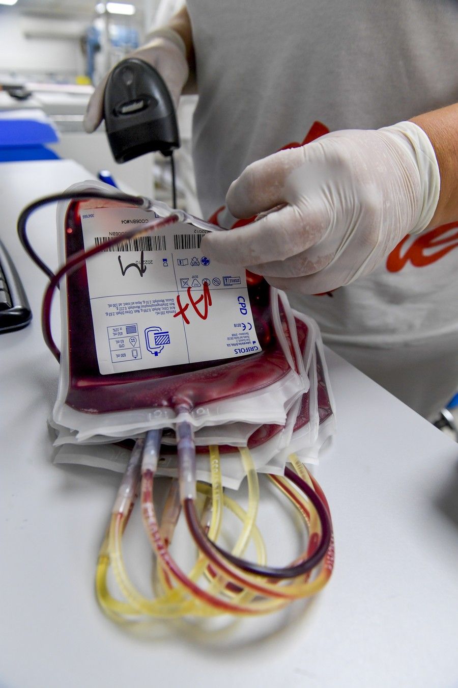 Almacenamiento de las donaciones de sangre en el ICHH