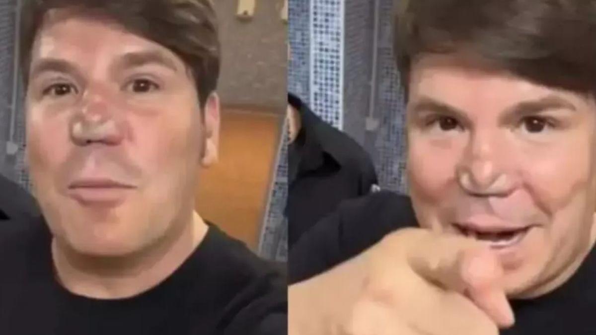 Una doctora explica qué le ha pasado a la nariz operada de Lucas, de Andy y Lucas Ha mutado nivel máximo