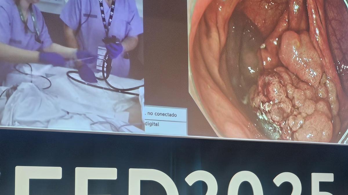 Momento del congreso sobre endoscopia digestiva.