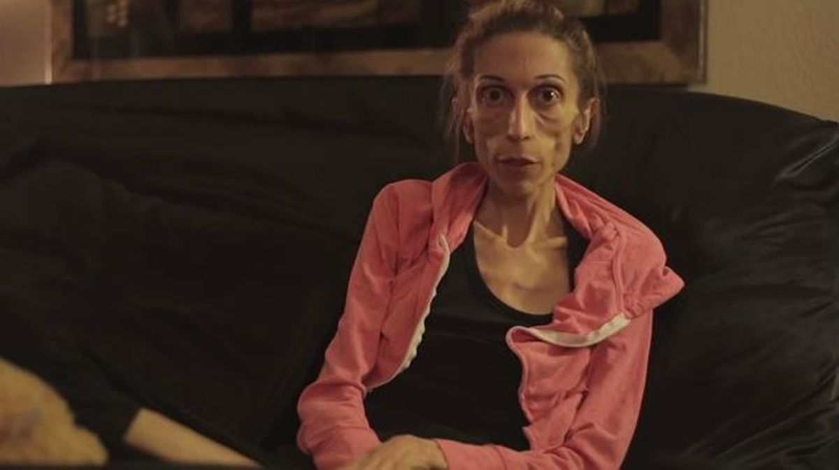 La actriz de 37 años, 1,70 y 20 kilos de peso Rachel Farrokh busca recaudar fondos para poder curarse de la grave anorexia que padece.