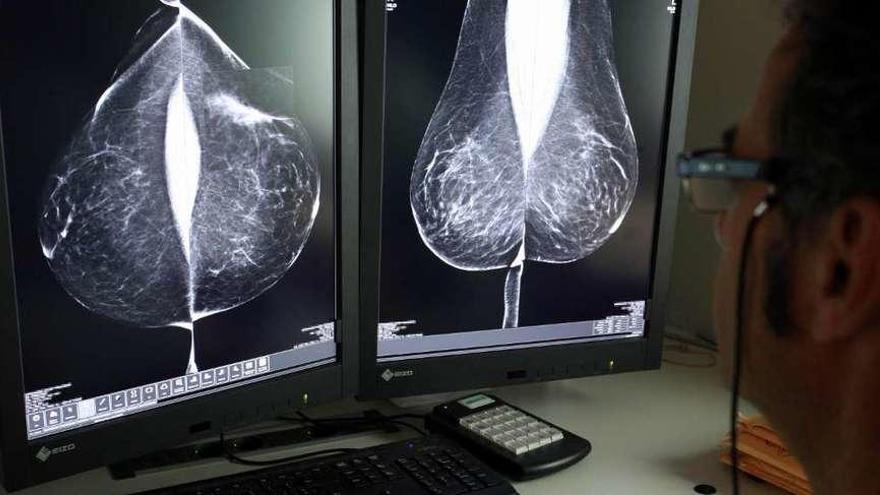 Un médico estudia una mamografía.