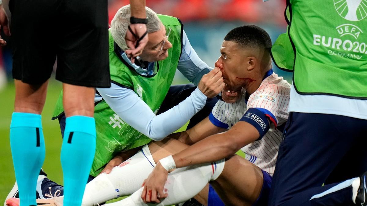 Mbappé terminó con sangre en la nariz tras un choque con Danso en la Eurocopa