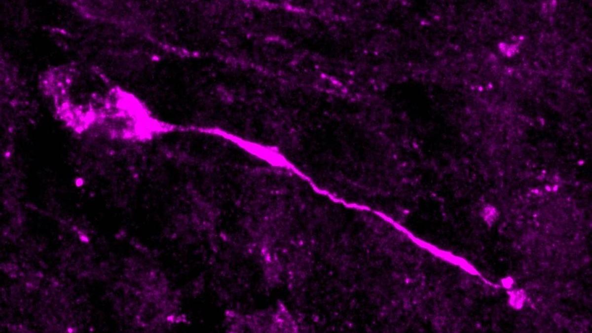 Imagen de microscopía de una célula glial radial basal en división, un tipo de célula progenitora que genera neuronas durante el desarrollo del cerebro.