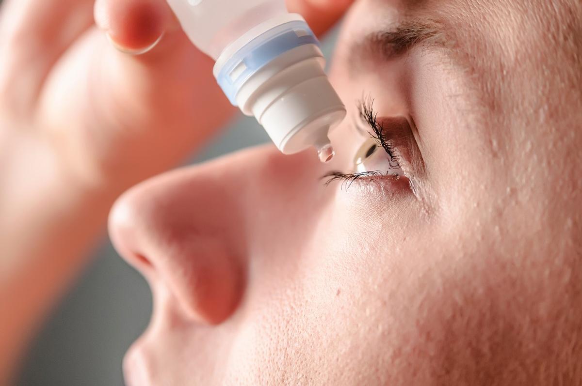 Artificial tears are the most commonly used treatment.