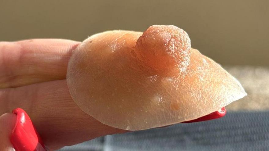 Prótesis de areola y pezón hechas con silicona médica.