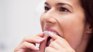 Los odontólogos avisan: el uso de alineadores sin prescripción puede causar problemas en el oído
