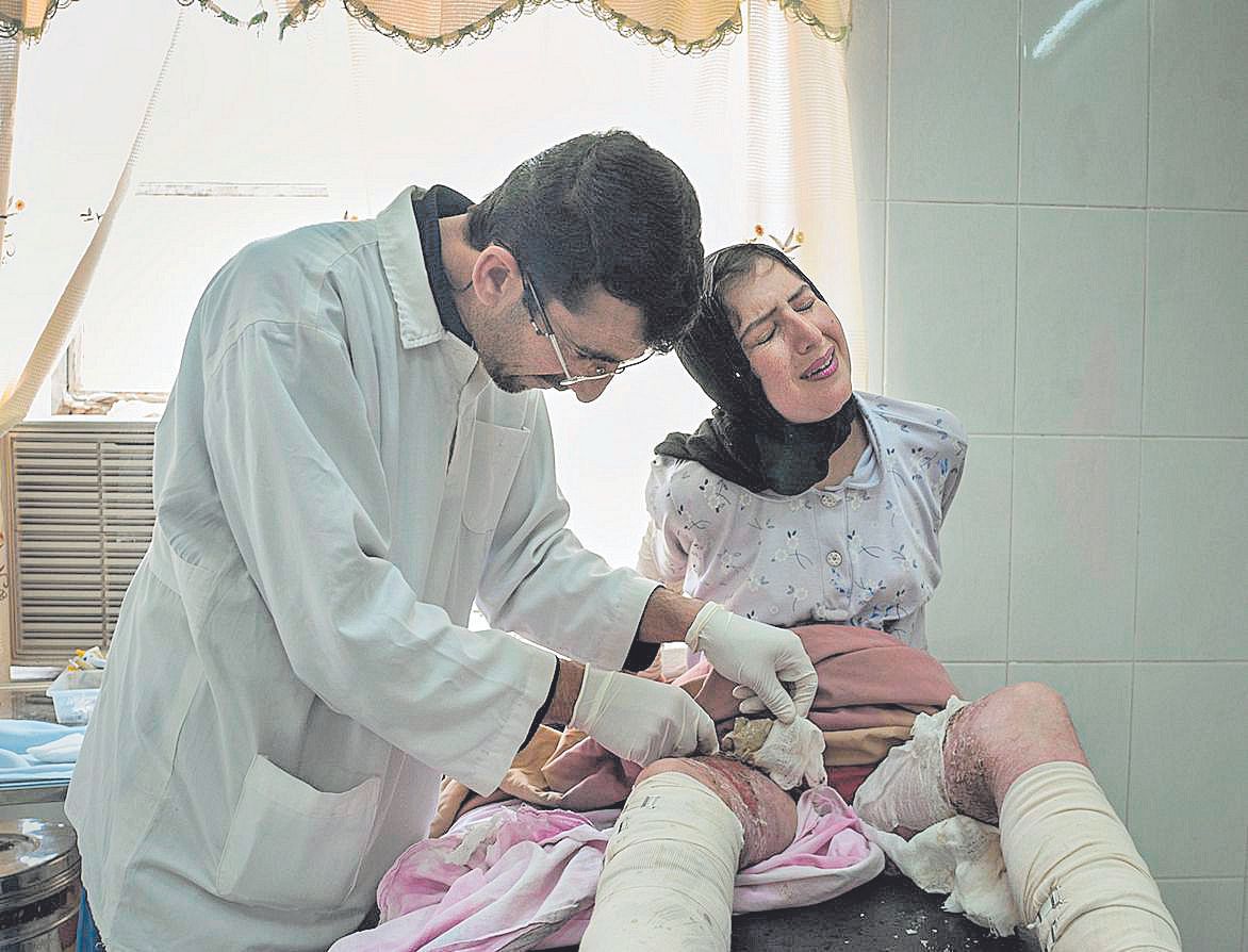 Haurin Khader, de 15 años, es curadas de sus heridas en el hospital de Erbil, en el Kurdistán iraquí. Se había intentado suicidar a lo bonzo para frenar un matrimonio de conveniencia.