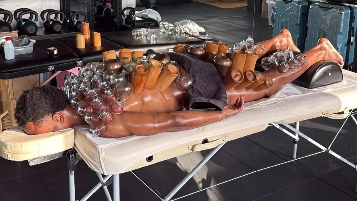 Openda, en una sesión de ventosaterapia