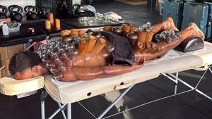 Openda, en una sesión de ventosaterapia