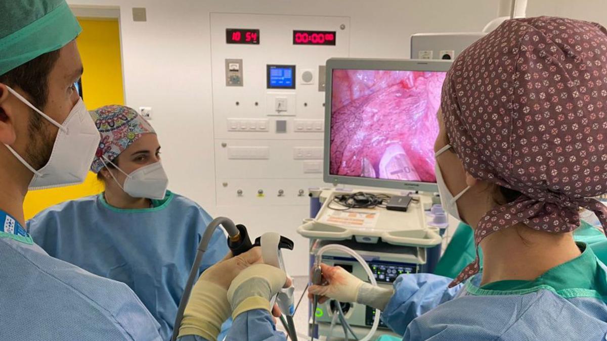 Un equipo quirúrgico  del Hospital Universitario  de A Coruña, durante una operación de pulmón mediante videocirugía. |   // LA OPINIÓN