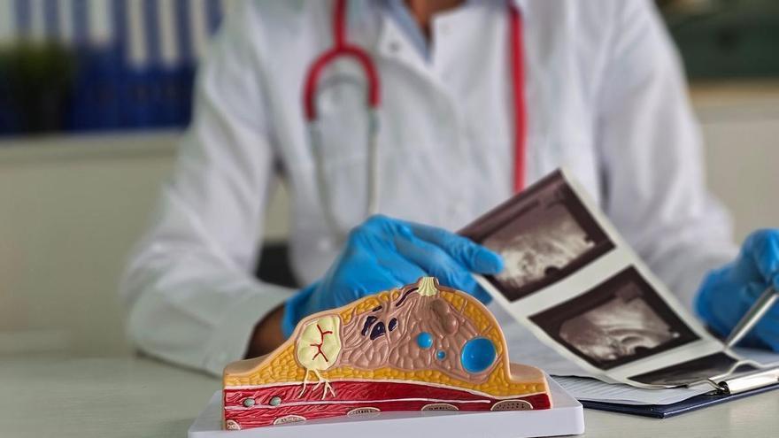 La Asociación Española Contra el Cáncer prevé más de 38.000 diagnósticos de cáncer de mama en 2026