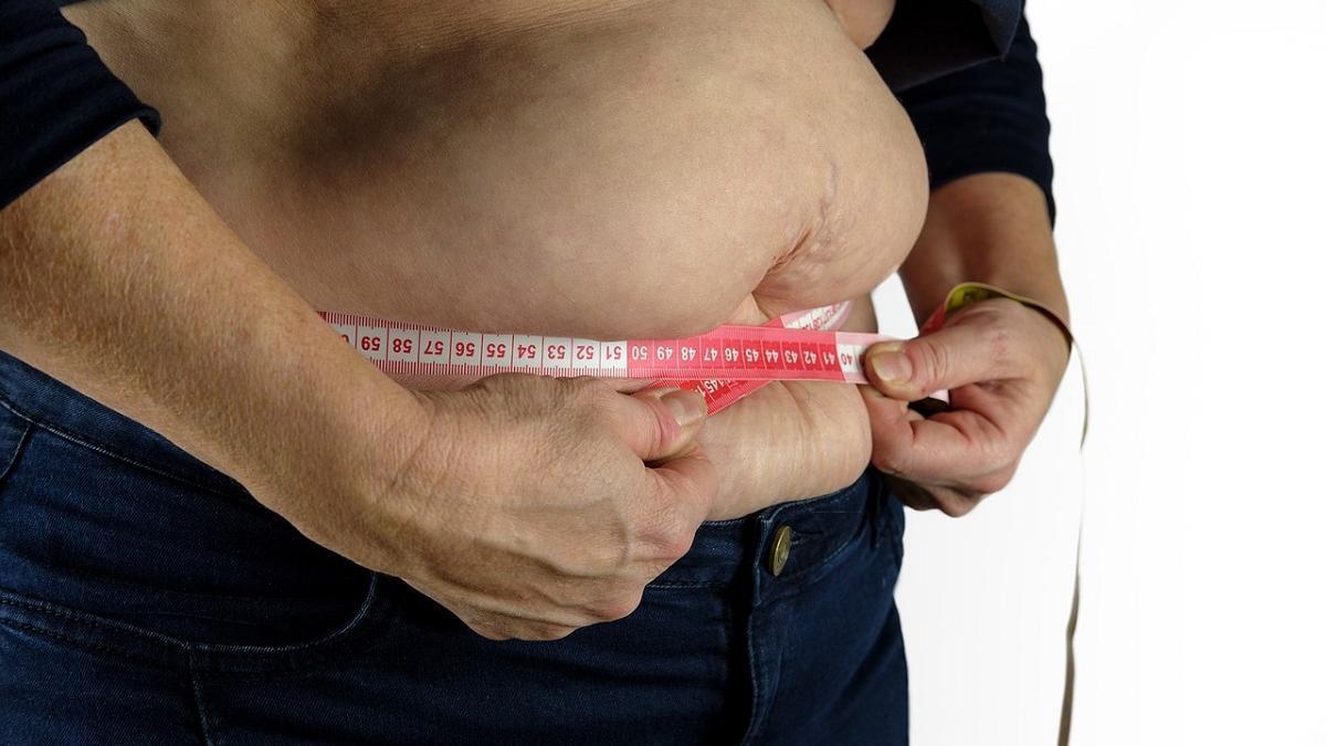 Imagen de una persona obesa.