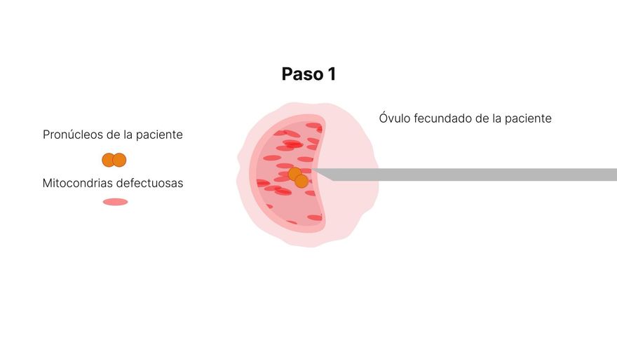 Recreación del proceso para lograr el nacimiento de un bebé sin que corra el riesgo de sufrir una patología mitocondrial. Fuente: Universidad de Newcastle