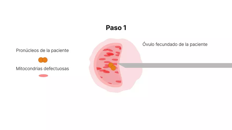 Recreación del proceso para lograr el nacimiento de un bebé sin que corra el riesgo de sufrir una patología mitocondrial. Fuente: Universidad de Newcastle