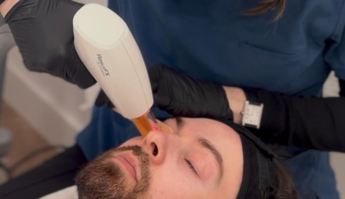 El protocolo que está redefiniendo el rejuvenecimiento facial