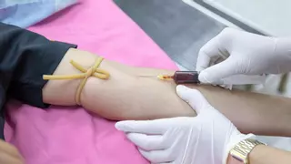 Alex Docampo, dermatólogo: "En tu sangre existe una sustancia extremadamente peligrosa"