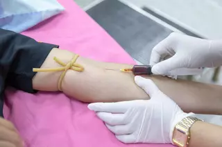 Alex Docampo, dermatólogo: "En tu sangre existe una sustancia extremadamente peligrosa"