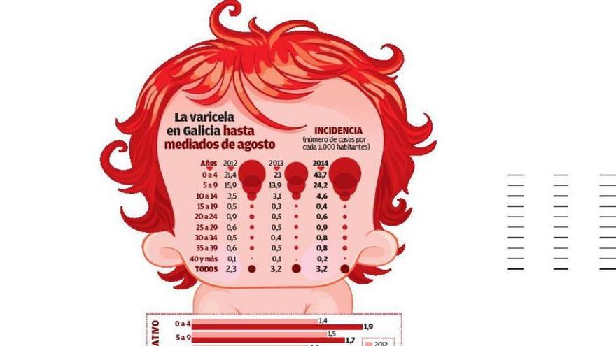 La varicela se dispara un 80% en Galicia tras la retirada de la vacuna en las farmacias
