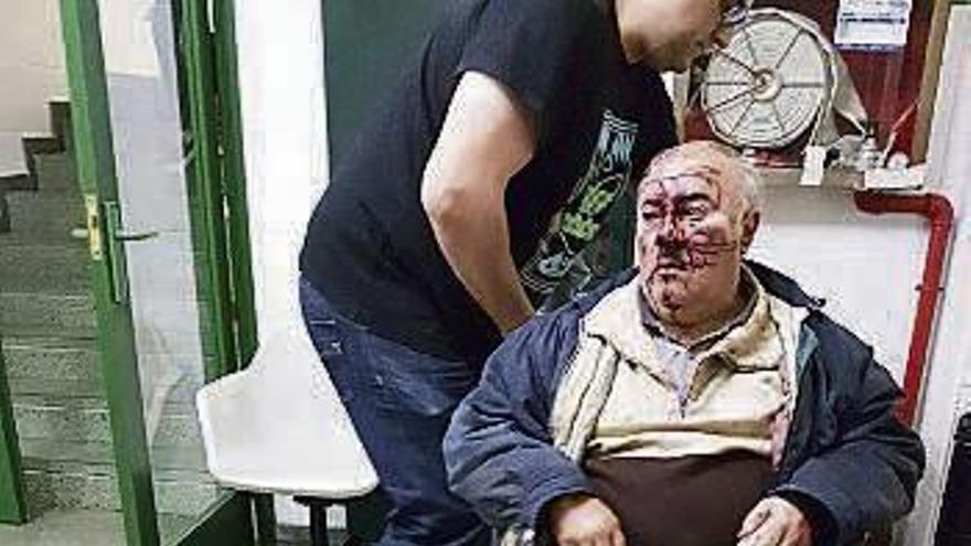 Buscan a un hombre de Bueu por agredir a su padre, que sufrió una fractura de nariz