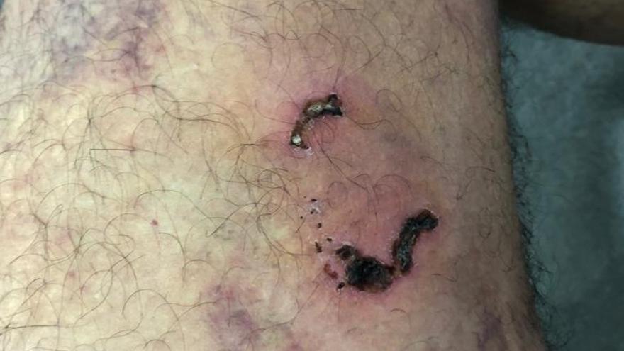El bull terrier que sembró el miedo en Sobradiel tras una oleada de ataques, a la perrera