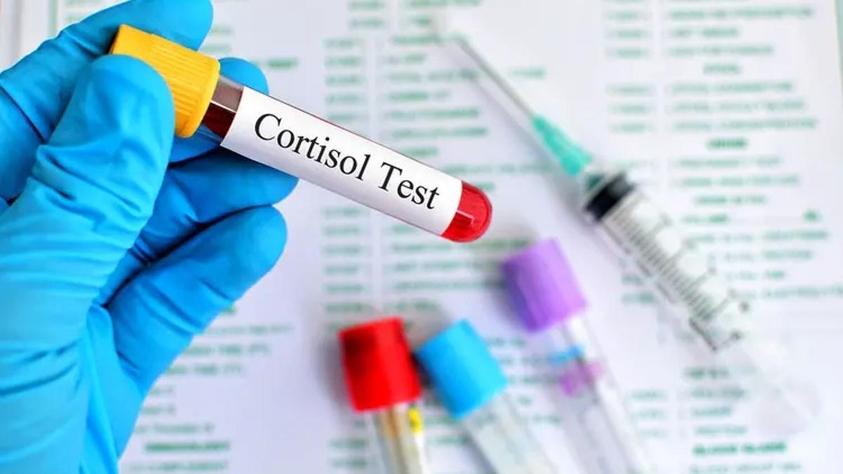 Un test de cortisol.