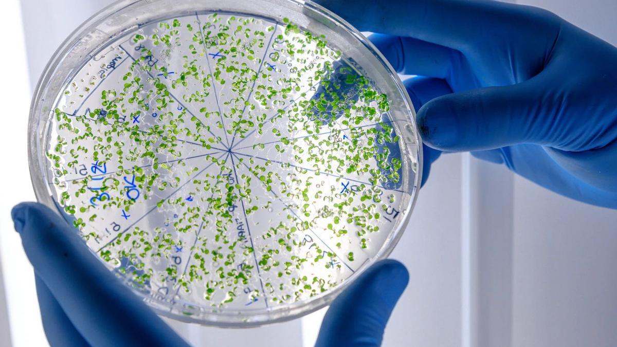 El diagnóstico de la infección por Legionella es sencillo mediante un análisis especial de orina.