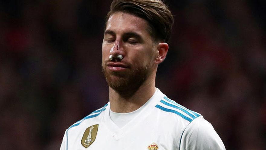 Sergio Ramos, con la nariz rota.