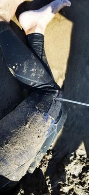 Se clava un arpón en una pierna en Puerto del Carmen