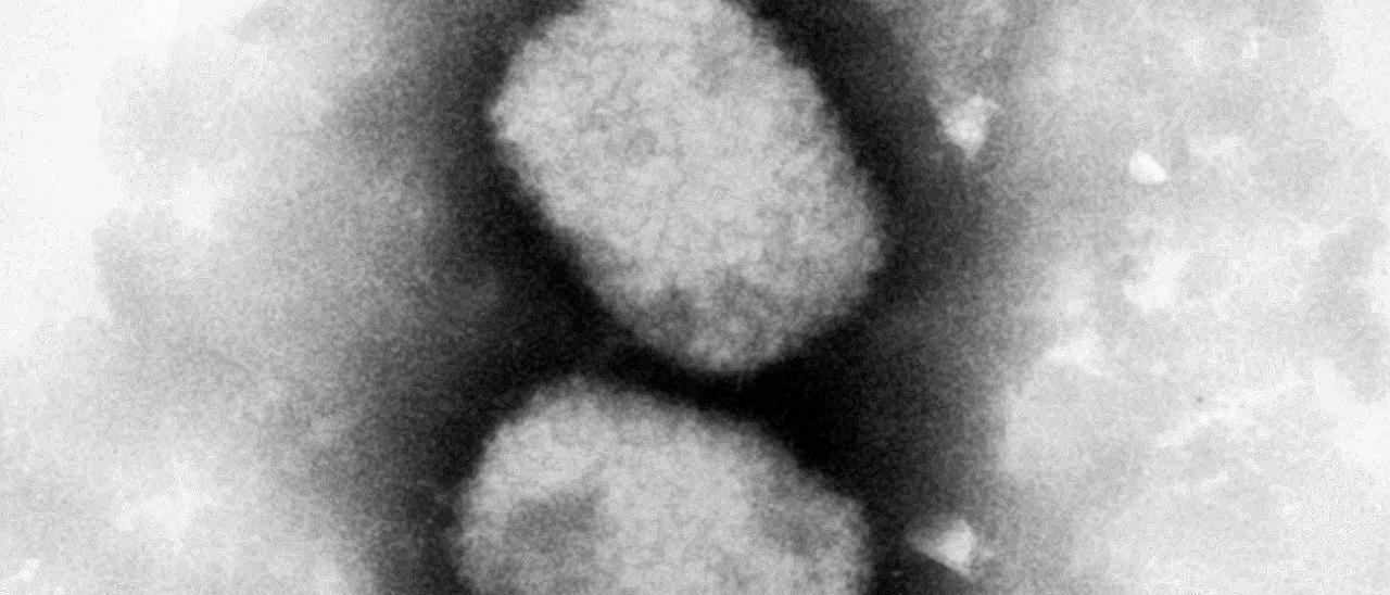Arxiu - El virus de la pigota dels micos