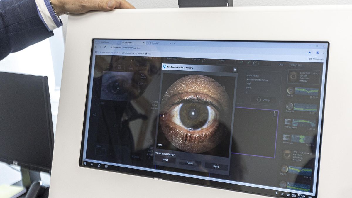Un robot con inteligencia artificial para agilizar la lista de espera en oftalmología