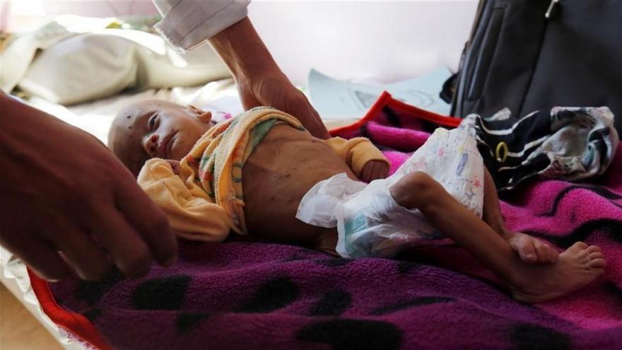 Más de 11 millones de niños necesitan ayuda urgente en Yemen