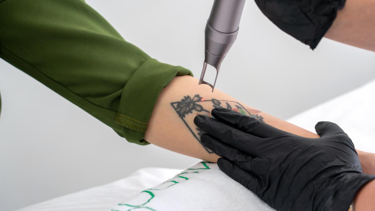 Las plataformas láser médico de pigmentos y el conocimiento en profundidad del uso de esta tecnología tan puntera y avanzada, permite eliminar los tatuajes.