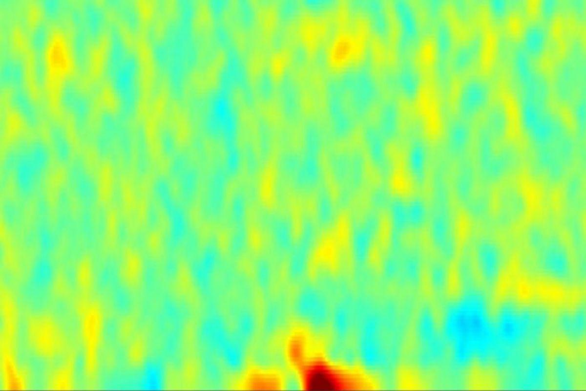 Un ejemplo de una huella cerebral de dolor obtenida por oscilaciones gamma.
