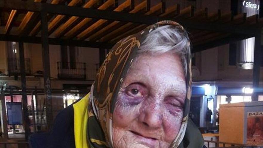 Una anciana sintecho sufre una brutal paliza en una calle de Madrid