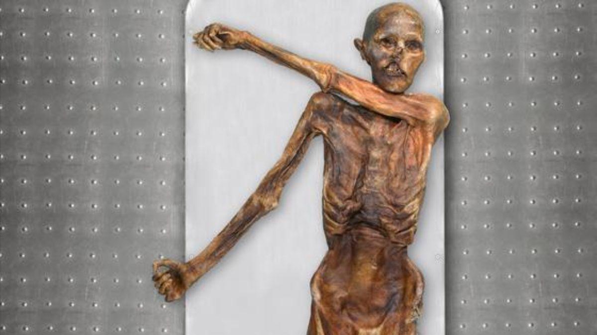 El virus del papiloma humano afectó a Ötzi hace más de 5.000 años atrás.