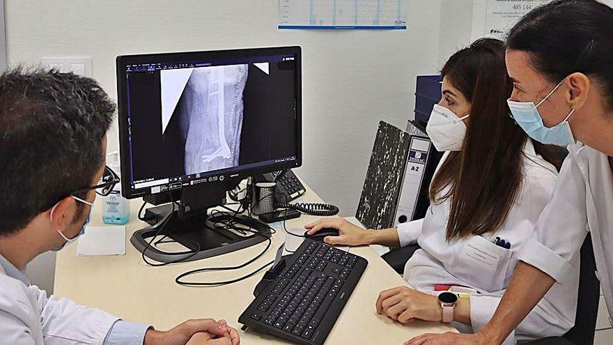 El doctor Gago y las doctoras González y Alonso, observan la radiografía de control postquirúrgico.