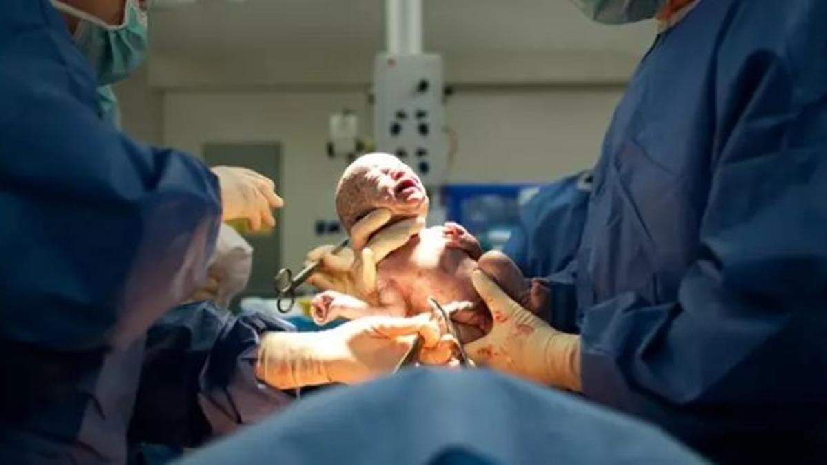 Un bebé nacido por cesárea