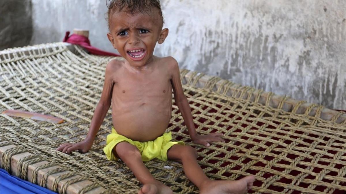 Un niño yemení malnutrido en la ciudad de Hodeida, en Yemen.