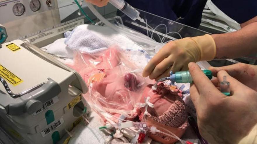 Operada con éxito la bebé que nació con el corazón fuera del pecho