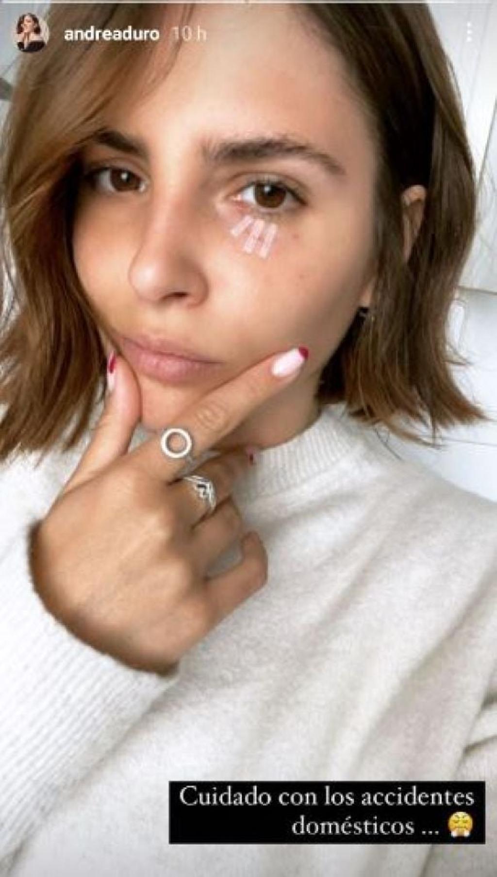 Andrea Duro comparte una foto de su accidente con unas tijeras