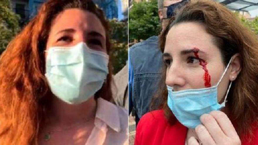 "Rocío de Meer se regenera mejor que Lobezno": Las redes cuestionan la agresión a la diputada de VOX