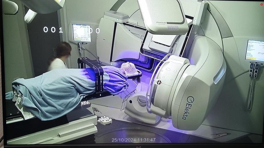 FOTOS | El Hospital de Son Espases realiza la primera radiocirugía estereotáctica a una paciente con una lesión cerebral