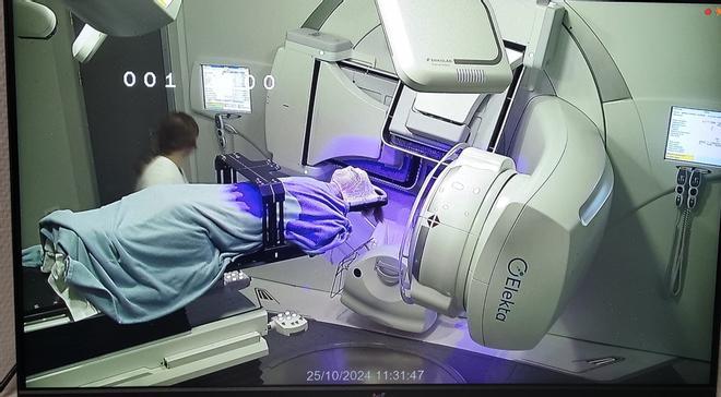 FOTOS | El Hospital de Son Espases realiza la primera radiocirugía estereotáctica a una paciente con una lesión cerebral