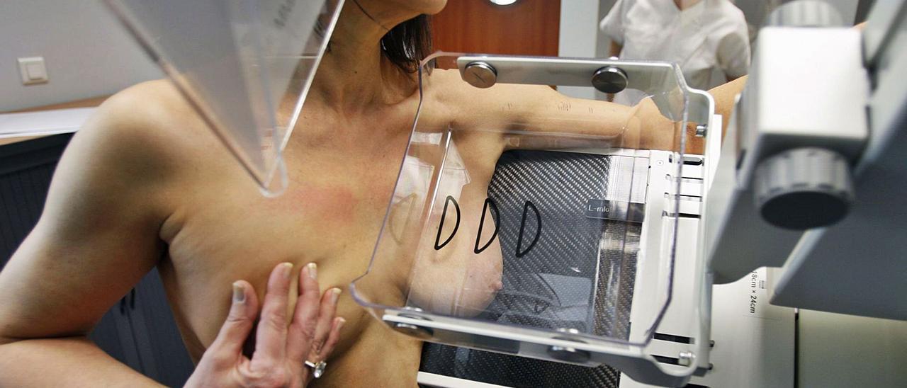 Imagen de archivo de una mujer sometiéndose a una mamografía en un programa de detección precoz. | REUTERS